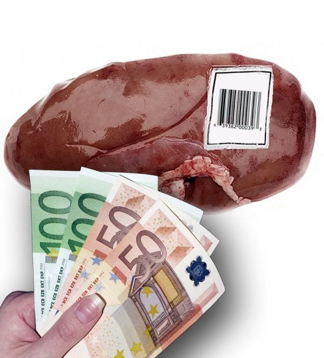 vrea sa-si vanda rinichiul, piata neagra de organe, saracie totala, disperat isi vine rinichiul