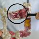 STUDIU // Tot mai mulți tineri sunt diagnosticați cu cancer. Cercetătorii analizează legătura cu îmbătrânirea biologică accelerată